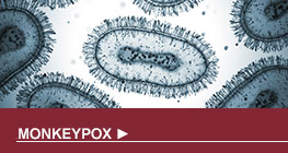Monkeypox-button 7.27.22 cm